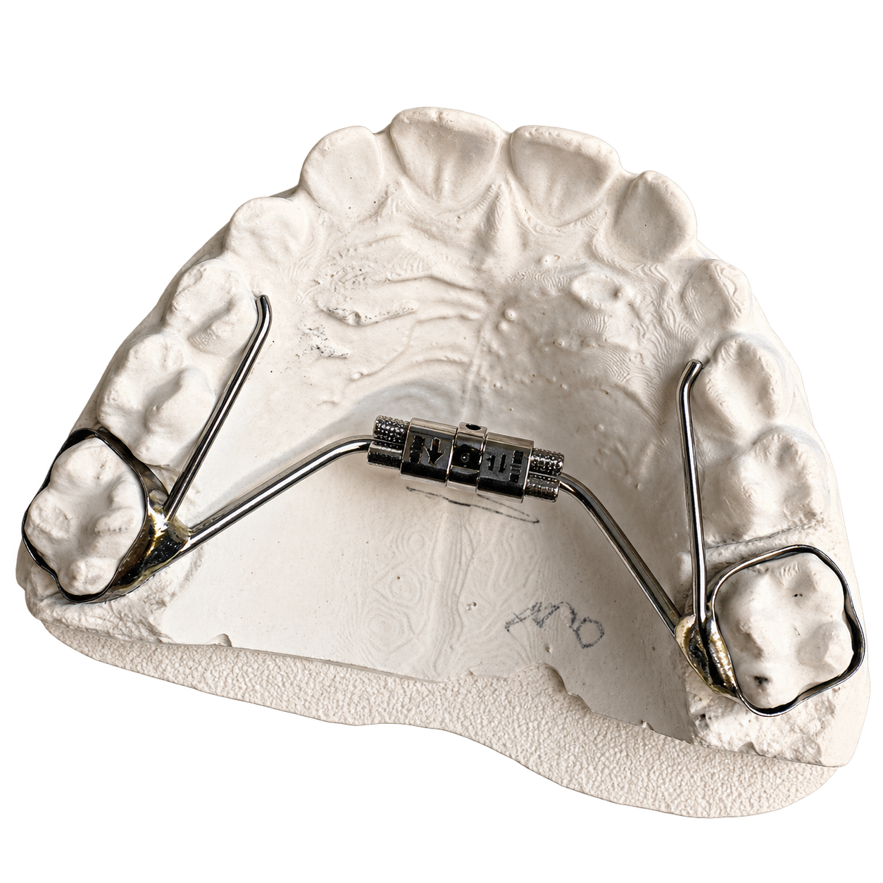 Leone Compact Expander fabricated by Retainer Express