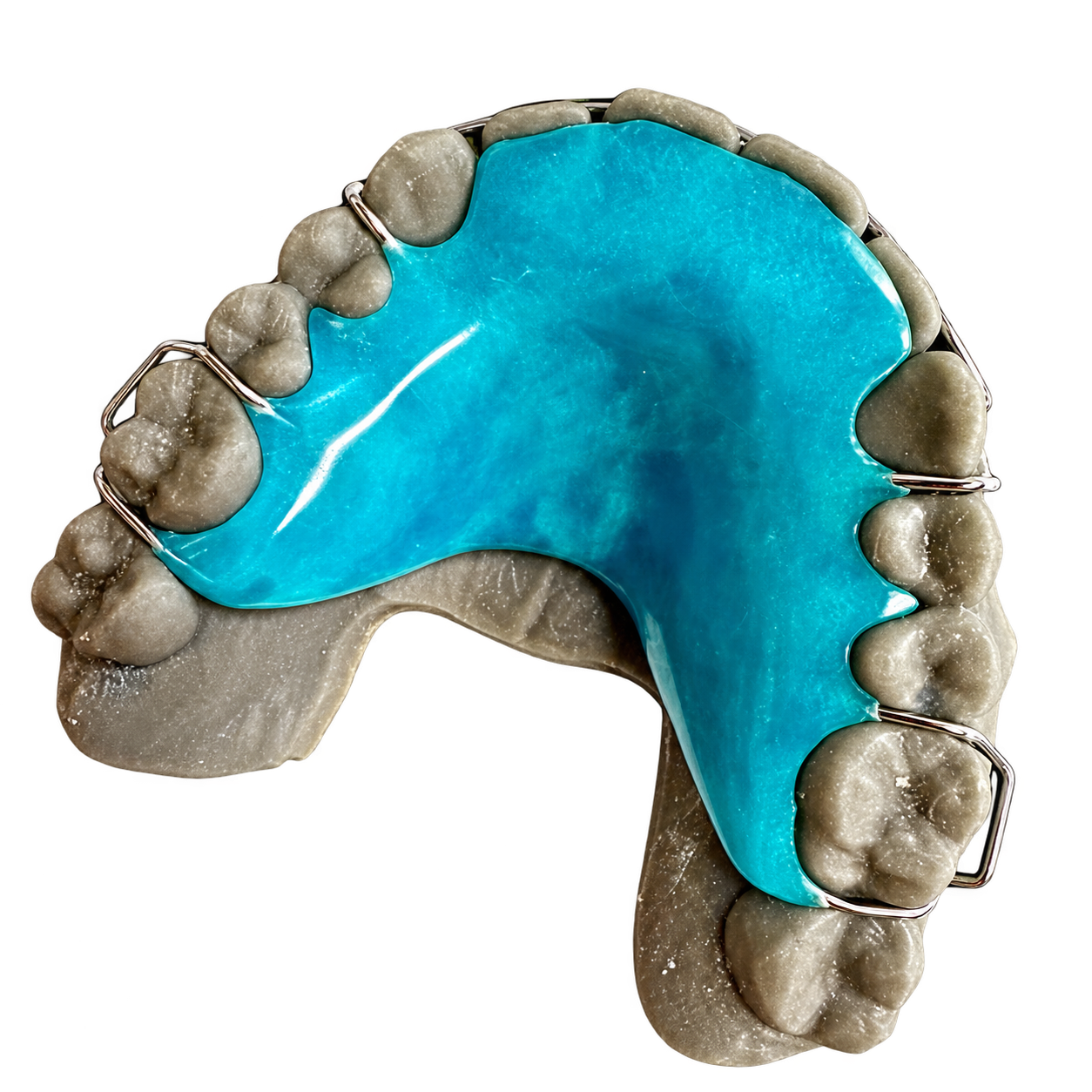 Hawley bite plate with Adams clasps fabricated by Retainer Express